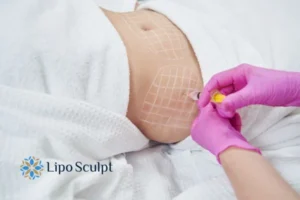 Are The Results From Aqualyx Permanent? 1 Do you want to know how long Aqualyx Epping Green results last?