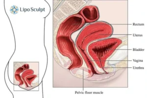 Treatment For A Leaky Bladder 2 How EM Chair treatment Epping Green can help Leaky bladder issues. Read more now!